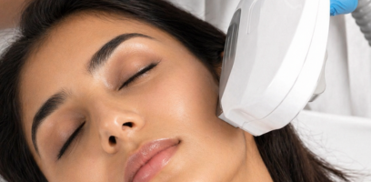 Laser pigmentation treatment
